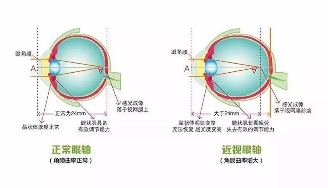 棱透镜的危害